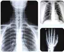Radiologia